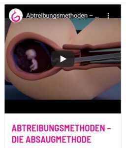 Screenshot Animationsfilm Abtreibung mittels Absaugmethode